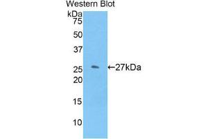 Western Blotting (WB) image for anti-Glutathione S-Transferase mu 1 (GSTM1) (AA 1-218) antibody (ABIN1859091) (GSTM1 antibody  (AA 1-218))