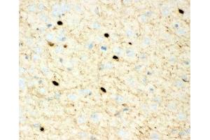 IHC-P: Calretinin antibody testing of mouse brain tissue (Calretinin antibody  (C-Term))