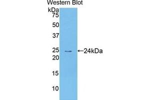 Detection of Recombinant TECK, Human using Polyclonal Antibody to Thymus Expressed Chemokine (TECK) (CCL25 antibody  (AA 24-150))