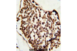 Formalin-fixed and paraffin-embedded human testisreacted with SETD8 monoclonal antibody, clone 43AT551.