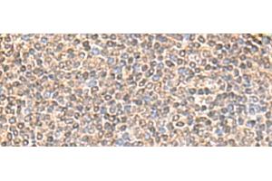 Immunohistochemistry of paraffin-embedded Human tonsil tissue using IQCD Polyclonal Antibody at dilution of 1:60(x200) (IQCD antibody)