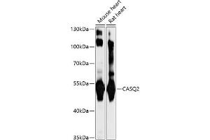 Western blot analysis of extracts of various cell lines, using C antibody (ABIN7266047) at 1:1000 dilution. (CASQ2 antibody  (AA 20-399))