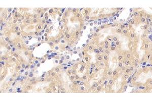 Detection of NPHN in Rat Kidney Tissue using Monoclonal Antibody to Nephrin (NPHN) (Nephrin antibody  (AA 39-106))