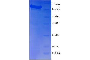 SDS-PAGE (SDS) image for Tyrosyl-tRNA Synthetase (Yars) (AA 2-528), (full length) protein (GST tag) (ABIN7479162)