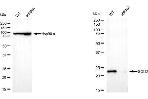 Western blotting analysis using superoxide dismutase 2 antibody (ABIN7800462). (SOD2 antibody)