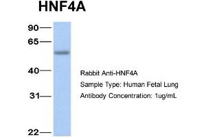Host:  Rabbit  Target Name:  HNF4A  Sample Type:  Human Fetal Lung  Antibody Dilution:  1.