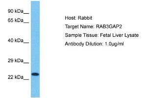 Host: Rabbit Target Name: RAB3GAP2 Sample Type: Fetal Liver lysates Antibody Dilution: 1.