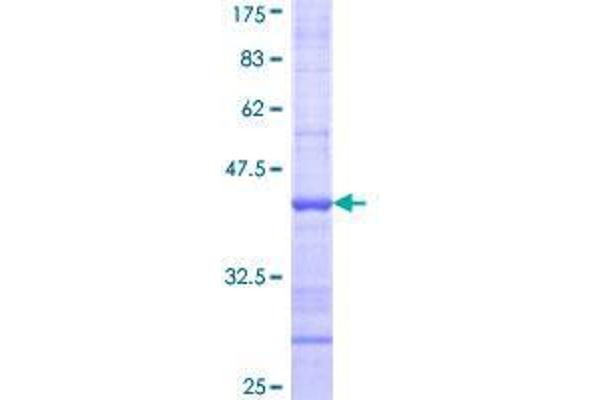 TRIM47 Protein (AA 539-638) (GST tag)