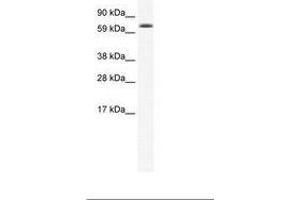 Image no. 1 for anti-Early B-Cell Factor 4 (EBF4) (AA 76-125) antibody (ABIN202734) (EBF4 antibody  (AA 76-125))