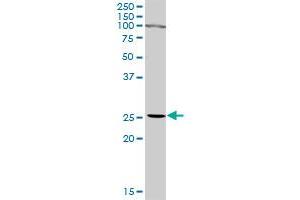 IFNA2 MaxPab rabbit polyclonal antibody. (IFNA2 antibody  (AA 1-188))