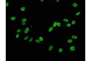 Immunofluorescence staining of Hela cells with ABIN7127289 at 1:34,counter-stained with DAPI. (Recombinant HIST1H3A antibody  (H3K4me2))