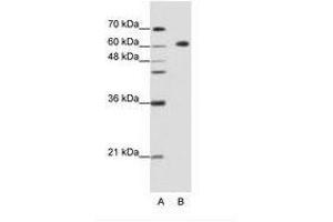 Image no. 2 for anti-Glucocorticoid Modulatory Element Binding Protein 2 (GMEB2) (C-Term) antibody (ABIN202723) (GMEB2 antibody  (C-Term))