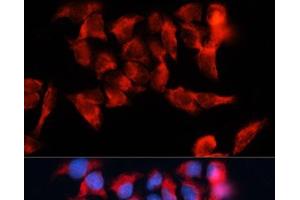 Immunofluorescence analysis of HeLa cells using BST2 Polyclonal Antibody at dilution of 1:100. (BST2 antibody)
