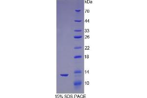 SDS-PAGE (SDS) image for Nephrosis 1, Congenital, Finnish Type (Nephrin) (NPHS1) protein (ABIN3010865)