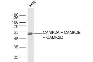 Mouse lung lysates probed with CAMK2A + CAMK2B + CAMK2D Polyclonal Antibody, Unconjugated  at 1:300 dilution and 4˚C overnight incubation. (CAMK2B antibody  (AA 1-100))