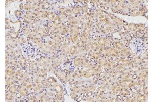 ABIN6269280 at 1/100 staining Mouse kidney tissue by IHC-P. (BMX antibody  (C-Term))