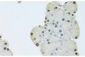 Immunohistochemistry (Paraffin-embedded Sections) (IHC (p)) image for anti-FIP1 Like 1 (FIP1L1) antibody (ABIN7263123)