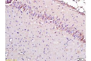 Immunohistochemistry (Paraffin-embedded Sections) (IHC (p)) image for anti-Apoptosis-Inducing Factor, Mitochondrion-Associated, 1 (AIFM1) (AA 131-230) antibody (ABIN724010)