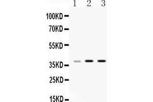 Western blot analysis of HnRNP A1 expression in rat liver extract ( Lane 1), mouse thymus extract ( Lane 2) and HELA whole cell lysates ( Lane 3). (HNRNPA1 antibody  (N-Term))