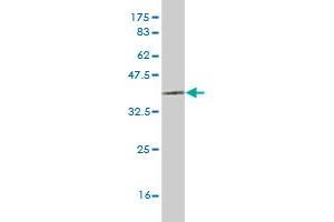 Western Blot detection against Immunogen (35. (LHX6 antibody  (AA 274-363))