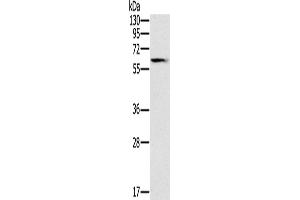 Western Blotting (WB) image for anti-Solute Carrier Family 45, Member 3 (SLC45A3) antibody (ABIN2433542) (SLC45A3 antibody)