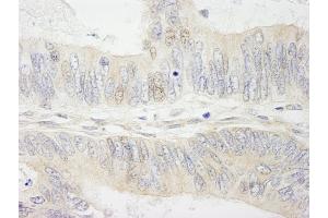 anti-Myb-Binding Protein 1A (MYBBP1A) (AA 450-500) antibody