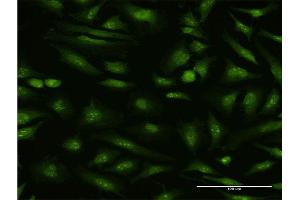 Immunofluorescence of monoclonal antibody to MTA1 on HeLa cell. (MTA1 antibody  (AA 601-700))