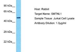 Host: Rabbit Target Name: SMTNL1 Sample Type: Jurkat Whole Cell lysates Antibody Dilution: 1.