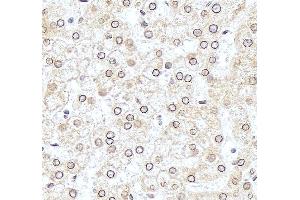 IHC analysis of TSR2 using anti-TSR2 antibody (ABIN7599035).