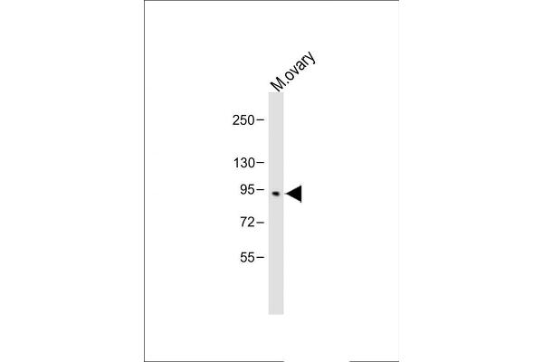 BAP1 antibody  (AA 36-66)