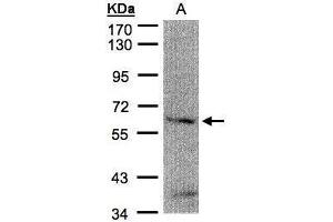 WB Image Sample(30 μg of whole cell lysate) A:H1299 7. (FANCG antibody  (Center))