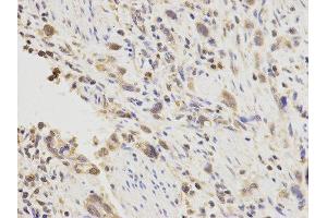 Immunohistochemistry (IHC) image for anti-Placenta Growth Factor (PGF) antibody (ABIN1874109) (PLGF antibody)