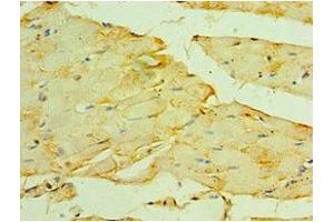 Immunohistochemistry of paraffin-embedded human skeletal muscle tissue using ABIN7160621 at dilution of 1:100 (Myotilin antibody  (AA 443-498))