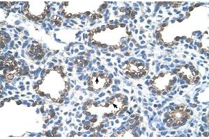 Human Lung (Erythrocyte Ankyrin antibody  (C-Term))