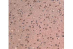 Used in DAB staining on fromalin fixed paraffin- embedded brain tissue (LAMB2 antibody  (AA 75-223))