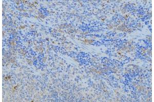 ABIN6277091 at 1/100 staining Human lymph node tissue by IHC-P.