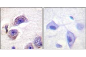 Immunohistochemistry analysis of paraffin-embedded human brain, using FAK (Phospho-Tyr407) Antibody. (FAK antibody  (pTyr407))