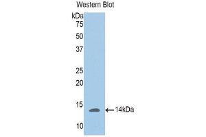 Western Blotting (WB) image for anti-Phosphoglucomutase 5 (PGM5) (AA 182-296) antibody (ABIN1176480)