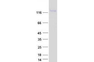 Validation with Western Blot (LNPEP Protein (Transcript Variant 1) (Myc-DYKDDDDK Tag))