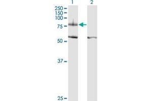 Western Blot analysis of ITGB8 expression in transfected 293T cell line by ITGB8 monoclonal antibody (M01), clone 2B4. (ITGB8 antibody  (AA 392-503))