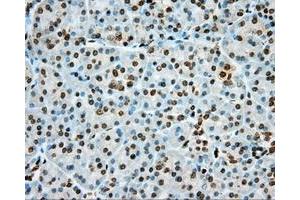 Immunohistochemical staining of paraffin-embedded Kidney tissue using anti-PRKG1 mouse monoclonal antibody. (PRKG1 antibody)