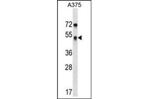 Western blot analysis of SEPT11 Antibody (Center) Cat. (Septin 11 antibody  (Middle Region))