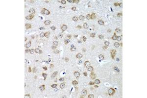 Immunohistochemistry of paraffin-embedded mouse brain using EIF1AX antibody (ABIN5973507) at dilution of 1/100 (40x lens). (EIF1AX antibody)