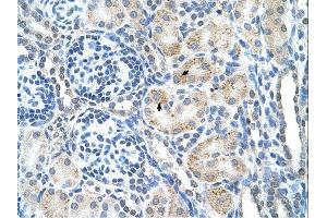 SPPL2B antibody was used for immunohistochemistry at a concentration of 4-8 ug/ml. (SPPL2B antibody  (N-Term))