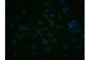 Immunofluorescence staining of PC3 cells with ABIN7163924 at 1:200, counter-stained with DAPI.