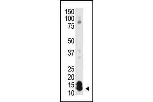 The anti-SUMO1 polyclonal antibody (ABIN1882136 and ABIN2845486) is used in Western blot to detect SUMO1 in HL-60 cell lysate. (SUMO1 antibody  (N-Term))