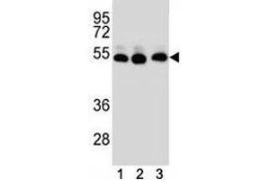 TUBB2B antibody western blot analysis of (1) HepG2, (2) HeLa, (3) MDA-MB231 lysate (TUBB2B antibody  (AA 12-39))