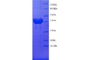 Histone H2B Type 1-C/E/F/G/I (LOC100407767) (AA 2-125), (full length) protein (GST tag)