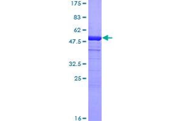 CA2 Protein (AA 1-260) (GST tag)