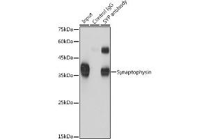 Immunoprecipitation analysis of 600 μg extracts of Mouse brain cells using 3 μg Synaptophysin antibody (ABIN6135349, ABIN6148783, ABIN6148784 and ABIN6221958).